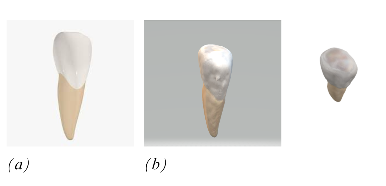A close-up of a tooth
Description automatically generated